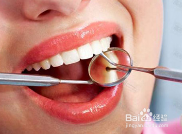 洗牙后如何养护呢？