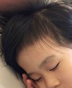 猕猴桃食疗小技巧