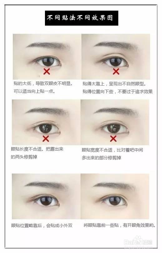 如何有效的贴双眼皮贴！