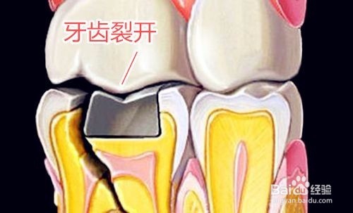 这些对待牙齿的习惯是错的你知道吗