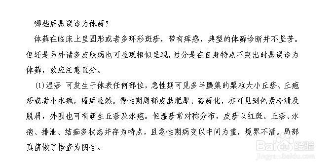 体藓怎么治好呢