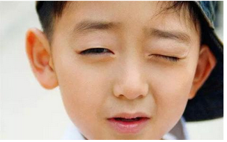 宝宝频繁眨眼做父母的需要注意什么