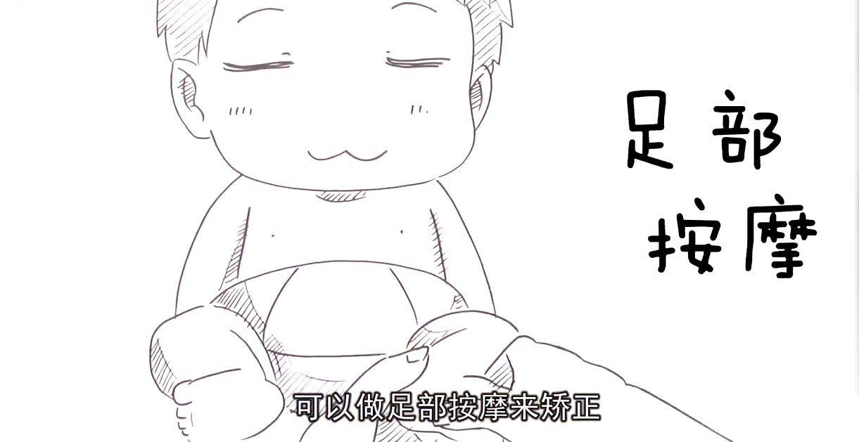 宝宝足内翻怎么办