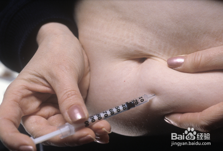 想知道自己有没有糖尿病,要查什么项目呢?