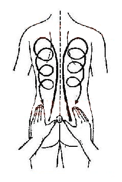 后背褥疮怎么办
