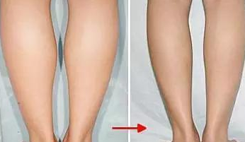 不同的腿型,不同的锻炼方法,看看那个适合您!