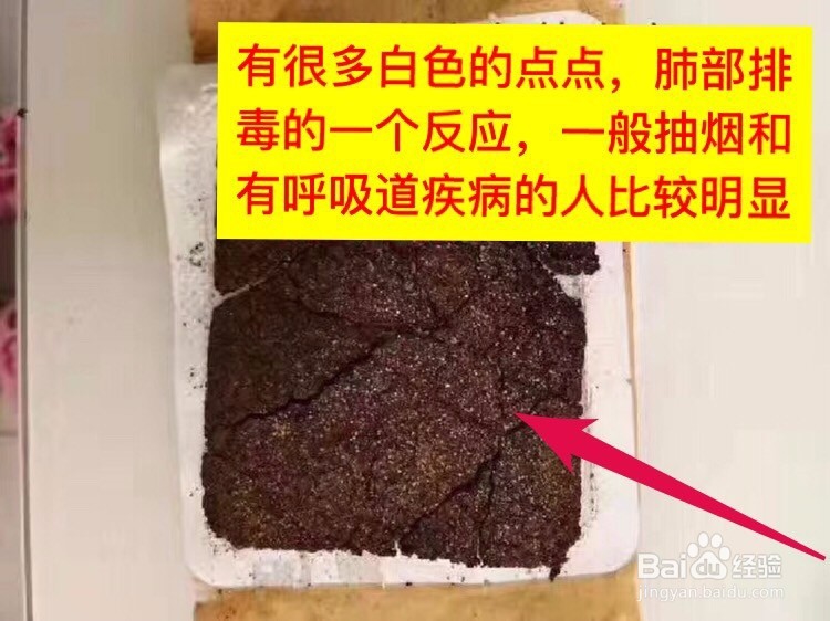艾热灸使用后药包颜色对比