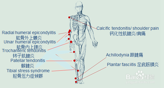 冲击波疼痛治疗仪的简介和使用方法