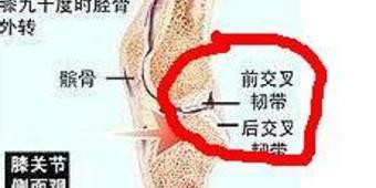 打篮球如何保护膝盖