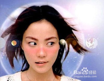 出现了晒伤怎么处理
