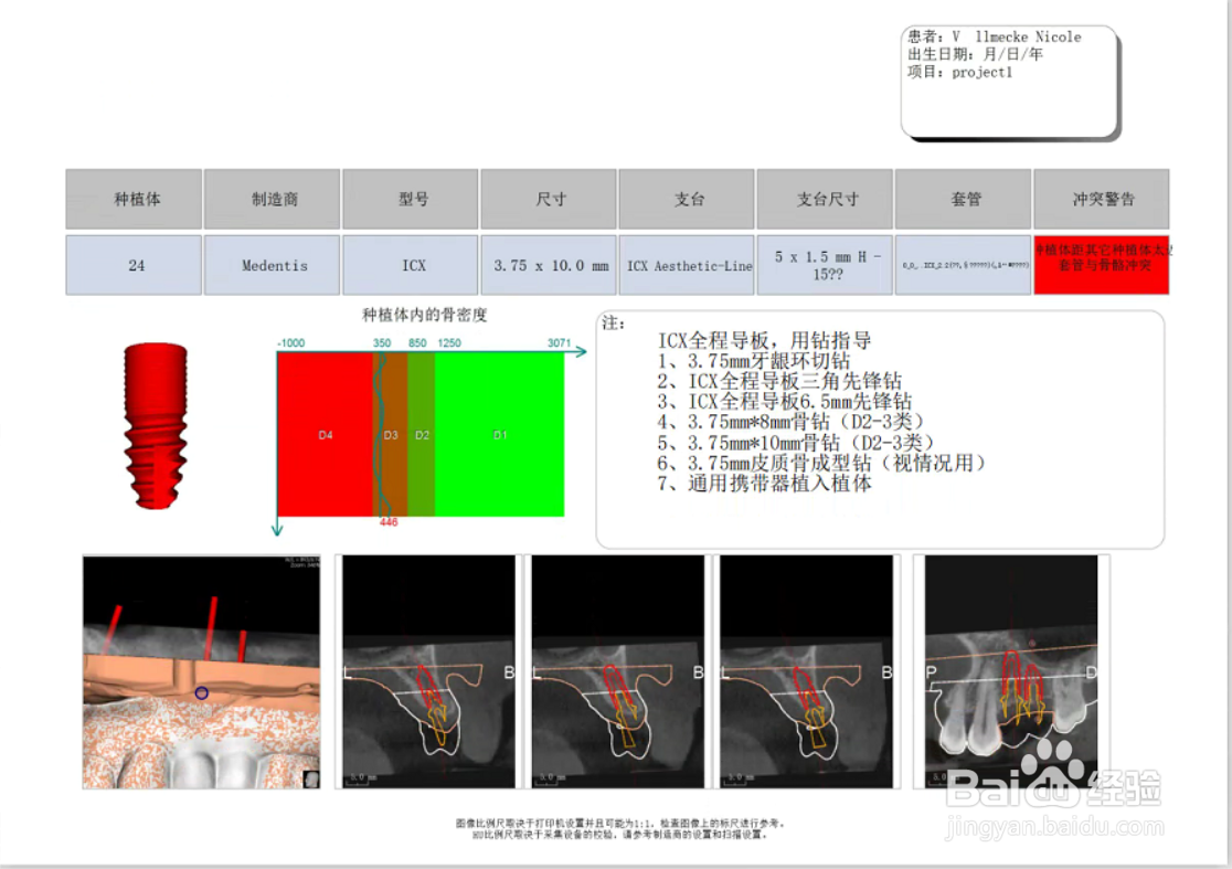 牙齿缺失|数字化种植牙与传统种植牙的区别