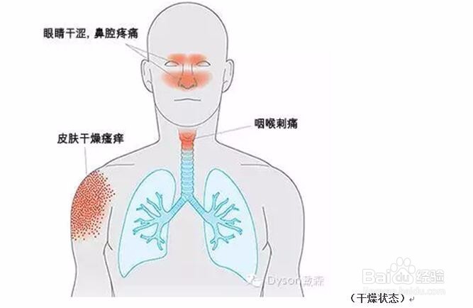 加湿器正在发射细菌你信吗？家用加湿器如何选购