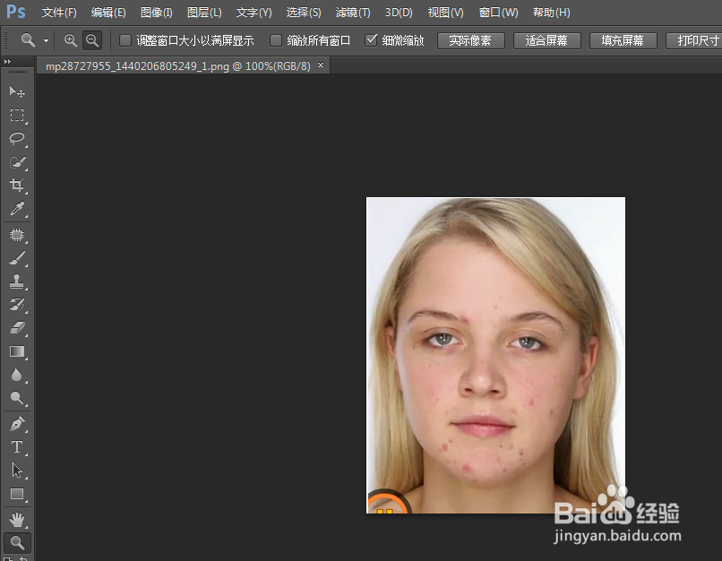 如何使用PS去掉痘痘？