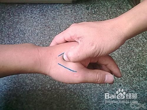 怎样去除黑眼圈？？？