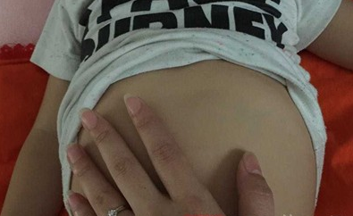 宝宝满月了脸还有点黄怎么办