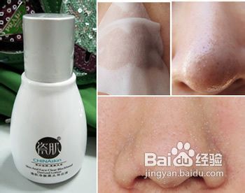 怎样去除黑头更有效