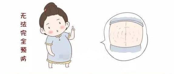 妊娠纹怎样预防