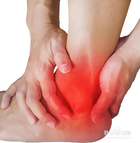 扭伤后是热敷还是冷敷？