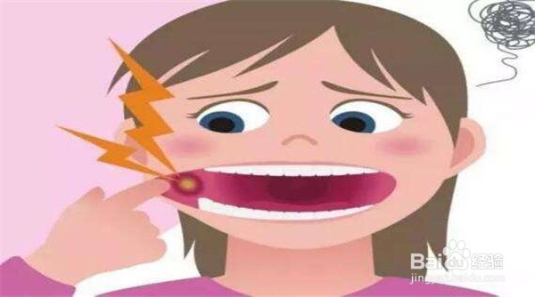 出现口腔溃疡的解决办法