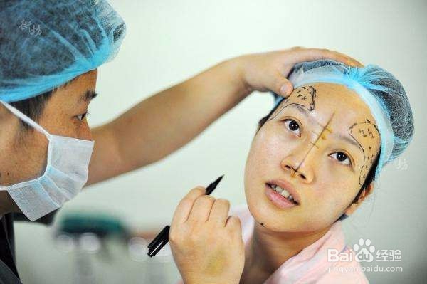 内双能割双眼皮吗