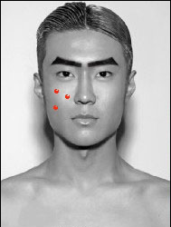 祛痘的小窍门不同部位的祛痘方法