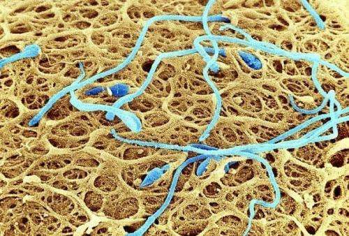 怎样确诊血精症的病因呢?