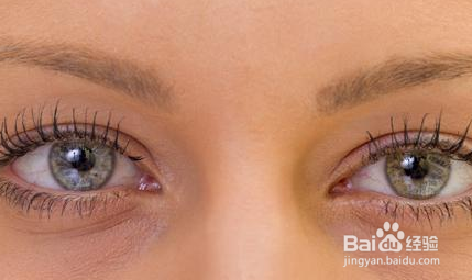 如何预防青光眼?