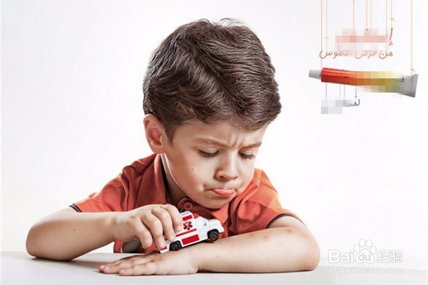 宝宝被蚊子叮咬后该怎么办？蚊子叮咬后如何止痒