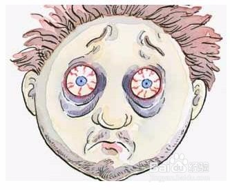 如何正确预防葡萄膜炎的复发