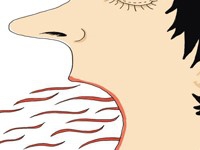 胃气上逆怎么办