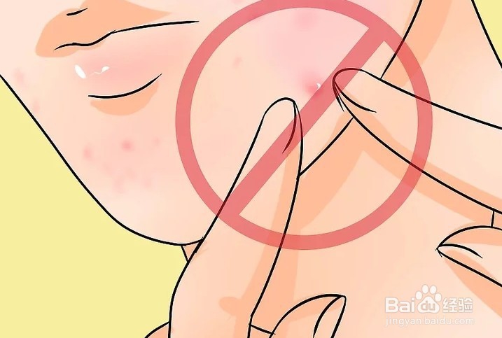 初中生怎样祛痘变白