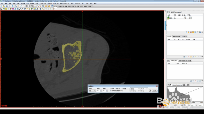 Mimics如何进行图像处理操作