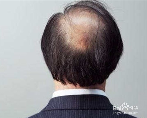 男人如何护理好自己呢？