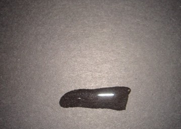 秋天颈部护理要点