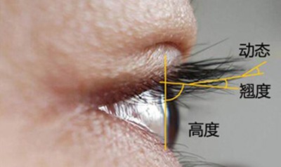 双眼皮手术有几种