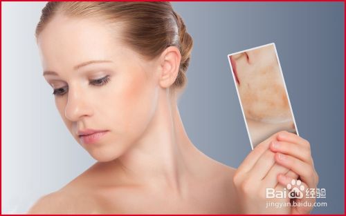 如何预防皮肤过敏