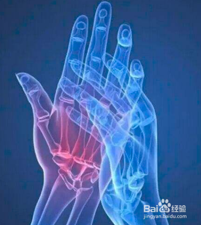 腰肌劳损怎么恢复?得了腰肌劳损怎么办?