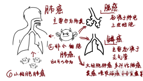 关于肺癌,你不知道的那些事儿