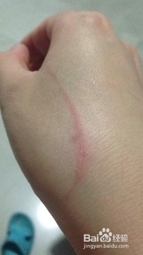 让狗狗抓破了皮怎么办