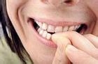爱咬指甲是怎么治疗