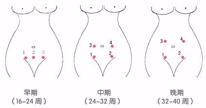 天使医生母婴远程监护操作指导