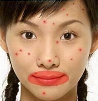 脸部痘痘辨别自己的身体信号！