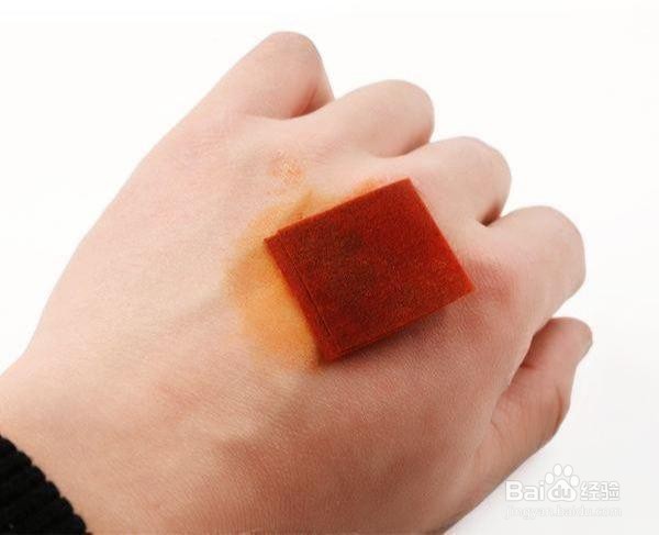 被狗咬了该怎么办?