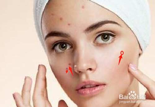 如何用PS去除图片人物脸上的斑点?