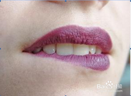 嘴唇脱皮、干裂怎么办