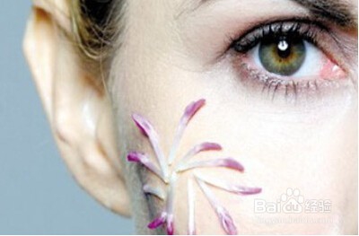 整形术后会不会有疤痕