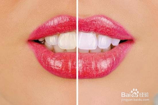 怎样让牙齿变得更白？