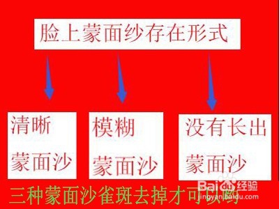 什么东西能去干净脸上蒙面纱/如何治疗蒙面沙好