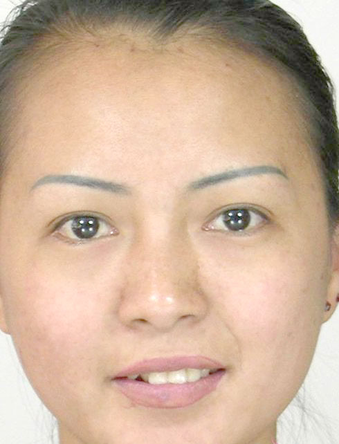 Photoshop CS2.0教你怎样祛痘和让图片亮