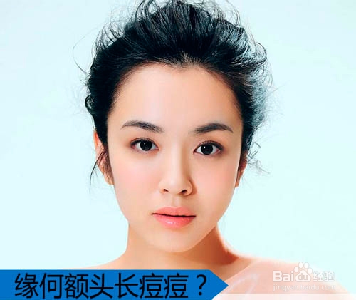 额头长痘怎调理 告别痘肌女